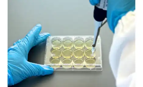 Agar Dilution AST